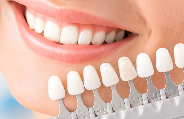 foto em porcelana vs foto em granito