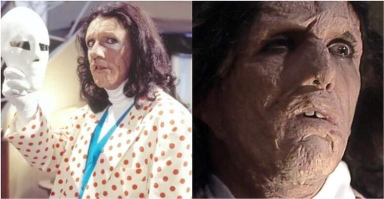 custo da cirurgia plástica do mascarado a viagem