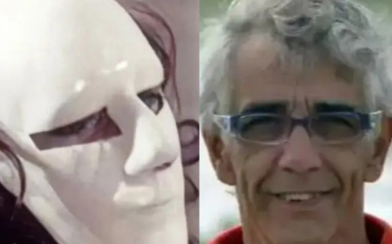 custo da cirurgia plástica do mascarado a viagem