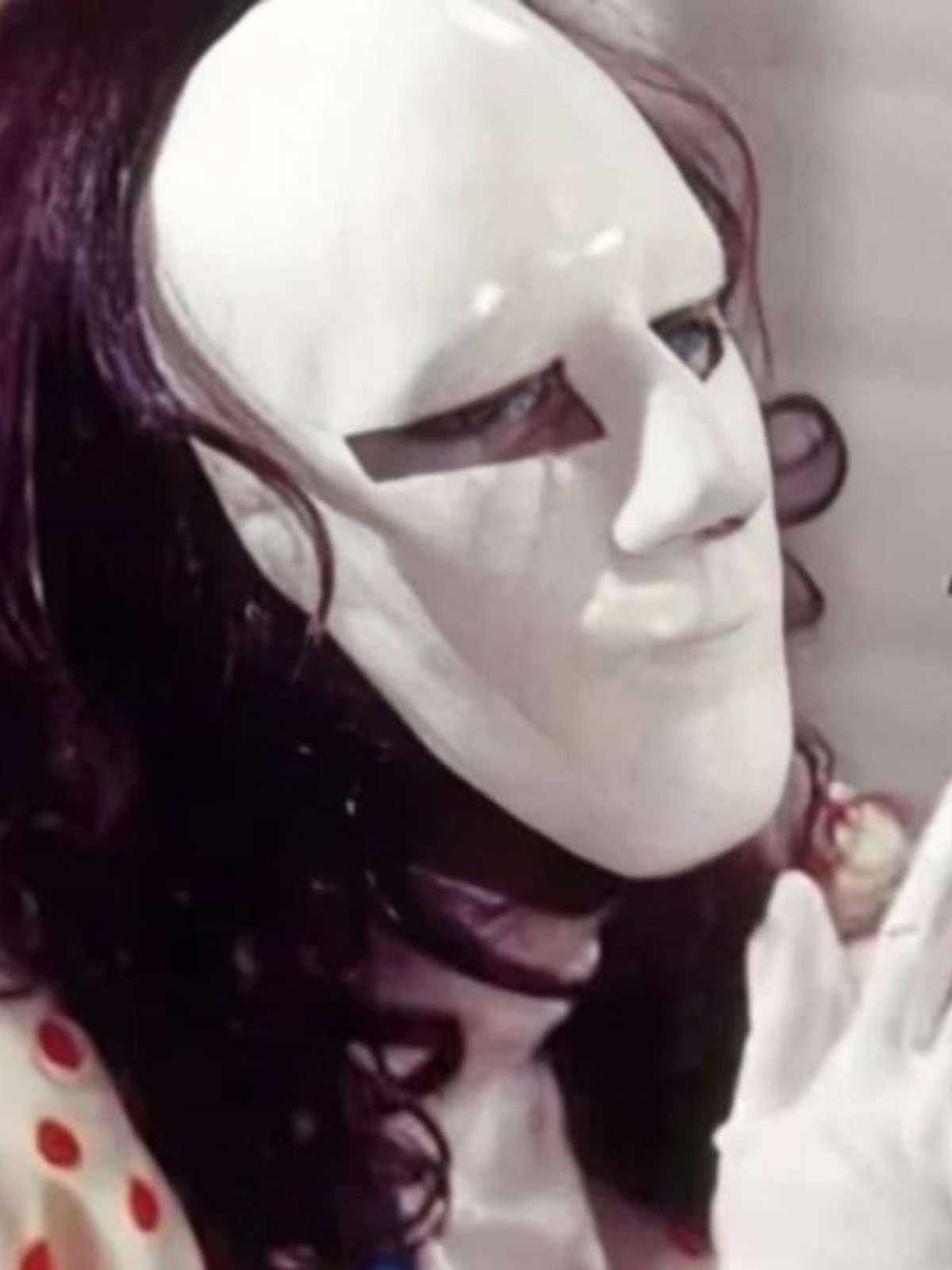 custo da cirurgia plástica do mascarado a viagem