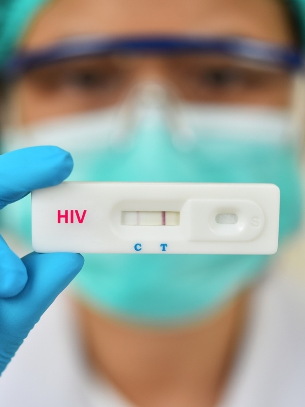 teste de hiv