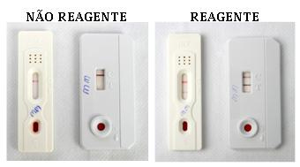 onde fazer teste de hiv gratuito perto de mim